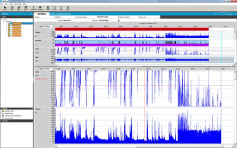 ResScan™ patient data management software 